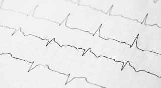Elektrocardiogram resultaten
