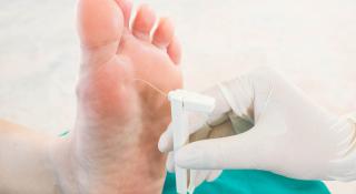 Monofilament bij voetonderzoek diabetes