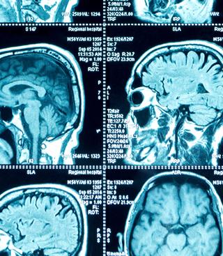 Dienst neurologie AZ Sint-Maarten